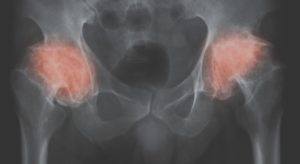 Hip Orthopedic Tests