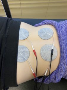 Electric Stimulation