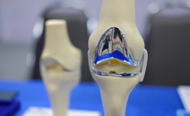 Physical Therapy After Knee Replacement